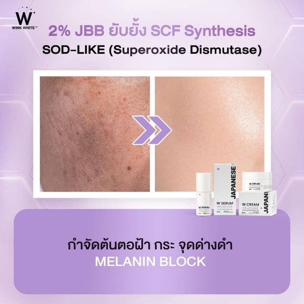 wink white w serum w cream w sun วิ้งไวท์ เซรั่ม ครีม กันแดด วิงค์ไวท์ ปัญหา ฝ้า กระ เกิดจาก คือ อย่างไร