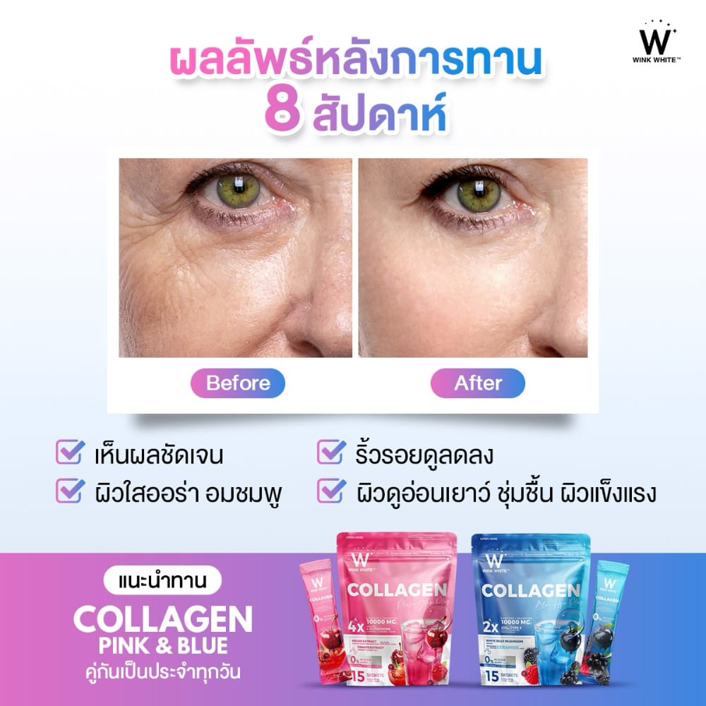  w collagen wink white blue pink วิ้งไวท์ คอลลาเจน วิงค์ไวท์ ผิวขาว กระจ่างใส ริ้วรอย ฝ้า กระ ปวด ข้อ เอ็น กระดูก เล็บ เส้นผม เซราไมด์ ไดเปปไทด์ ไตรเปปไทด์ ไฮโดร dipeptide tripeptide hydrolyzed ceramide