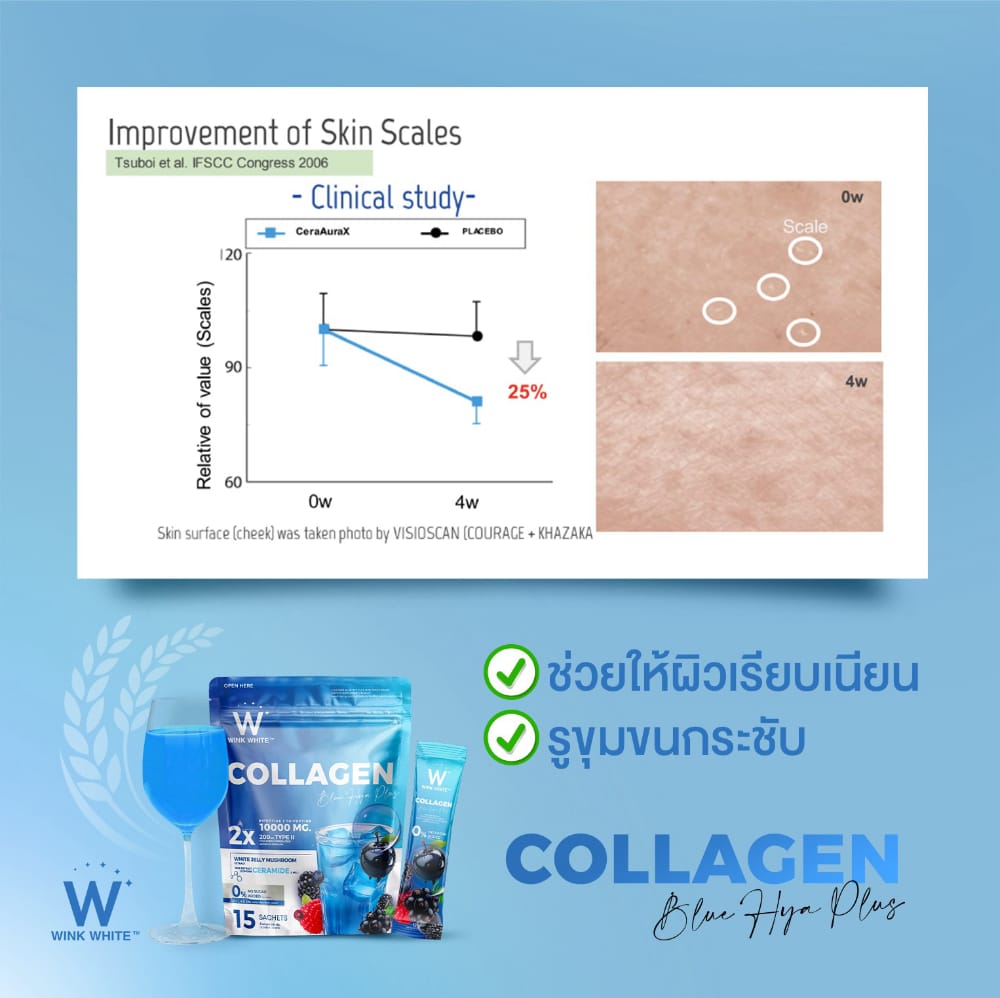 w collagen wink white blue pink วิ้งไวท์ คอลลาเจน วิงค์ไวท์ ผิวขาว กระจ่างใส ริ้วรอย ฝ้า กระ ปวด ข้อ เอ็น กระดูก เล็บ เส้นผม เซราไมด์ ไดเปปไทด์ ไตรเปปไทด์ ไฮโดร dipeptide tripeptide hydrolyzed ceramide