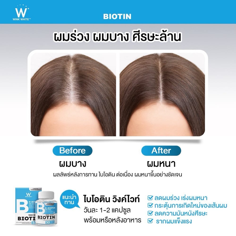 ไบโอติน วิงค์ไวท์ wink white วิ้งไวท์ ผมร่วง ผมบาง ฟื้นฟูผม ปลูกผม ผมสวย ปัญหา เส้นผม